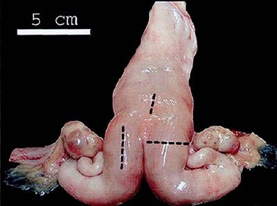 Postpartum Uterine Involution and Embryonic Development Pattern in Chinese Holstein Dairy Cows